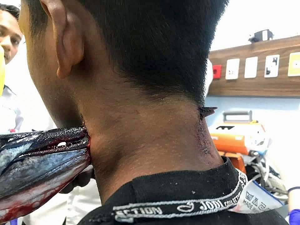 Fishingn can be a pain in the neck.